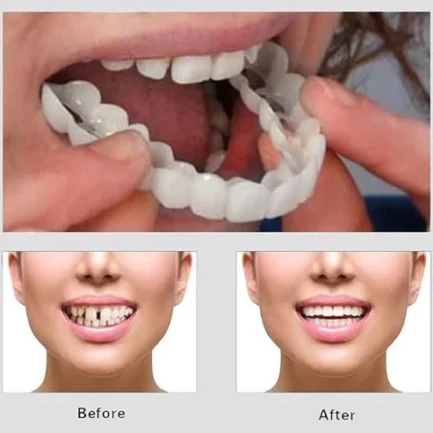 Snap On Smile Veneers Teeth For Men And Women Moldable False Artificial Braces Teeth - Image 4